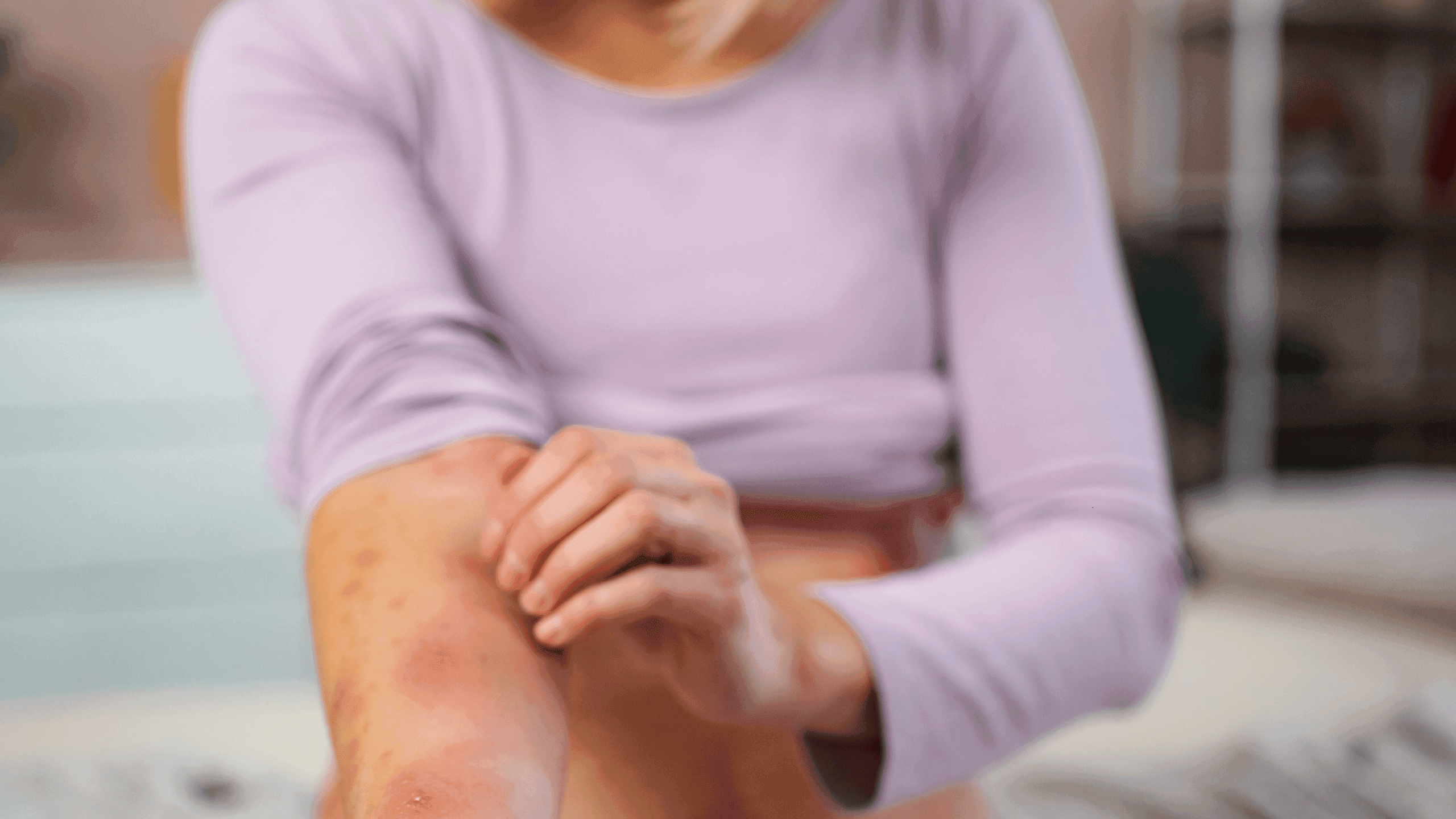 Križne alergije: Zašto vas peku usta od jabuke ako ste alergični na brezu?